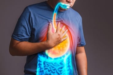 Does Acid Reflux Cause GI Cancer?