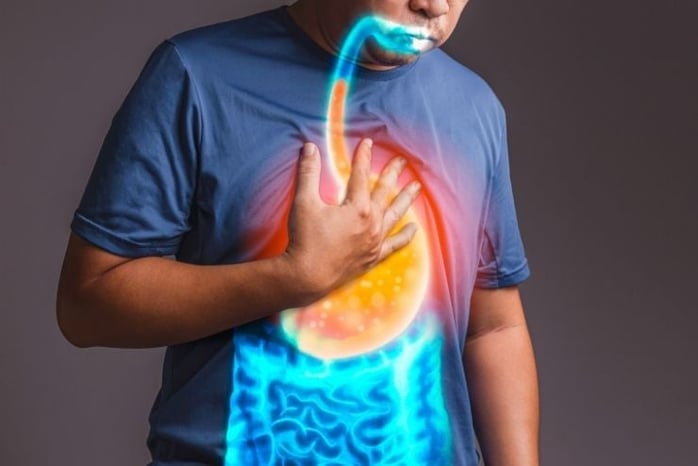 Does Acid Reflux Cause GI Cancer?